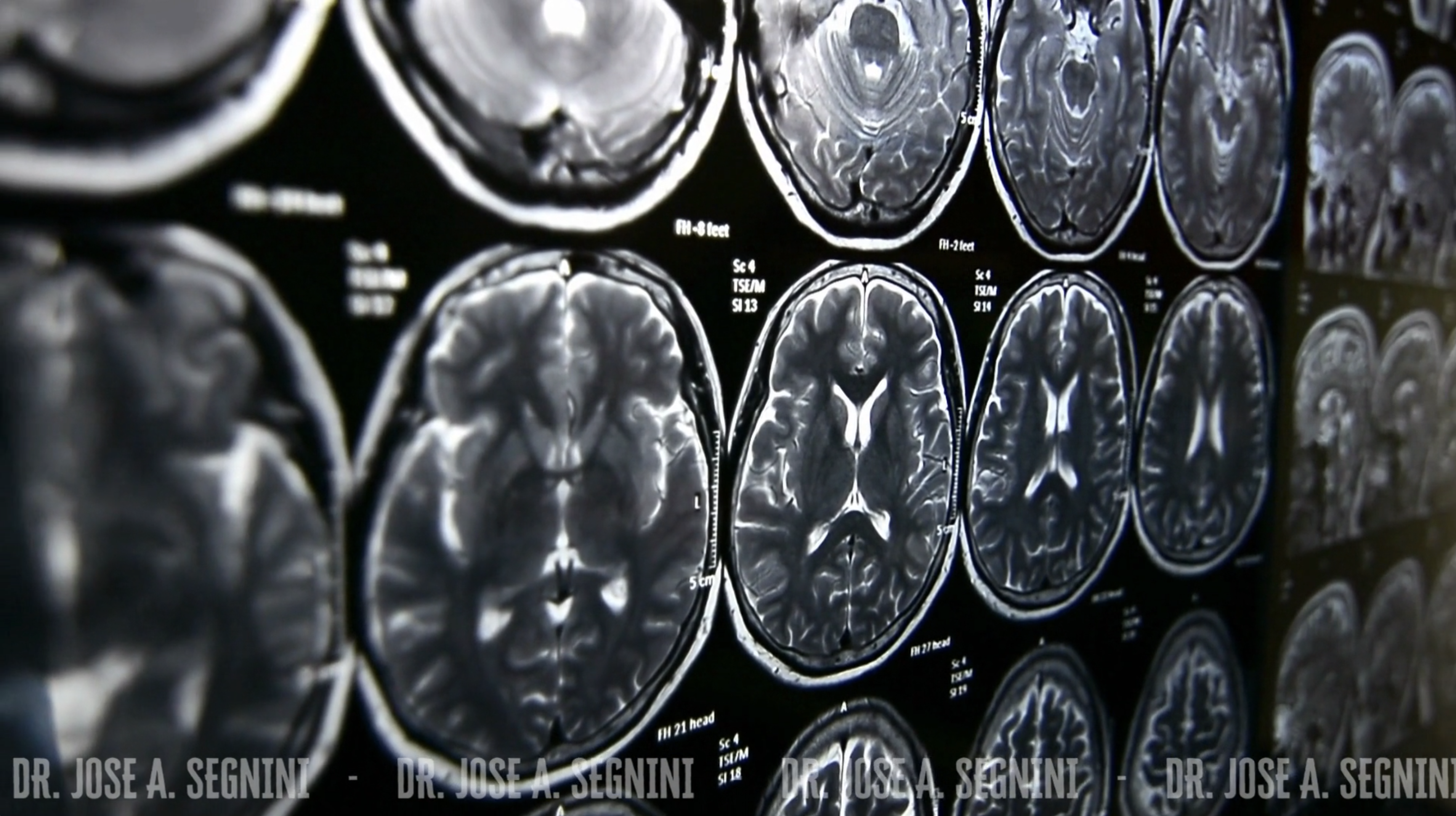 Dr. Segnini - Medical Supplies - Ultrasound - MD Radiologist